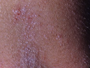 shipov-lish shipov-lish