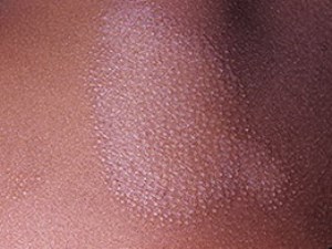 shipov-lish2 shipov-lish2