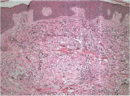 skleromix2 skleromix2