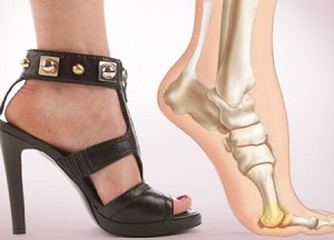 stopa_kabluki_polozhenie stopy