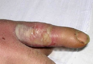 sus-panar2 sus-panar2