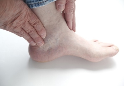 tarsal_tunnel2 tarsal_tunnel2