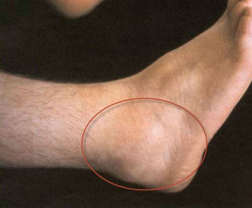 tenosin-gs tenosin-gs