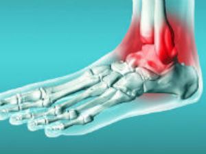 tenosin-gs2 tenosin-gs2