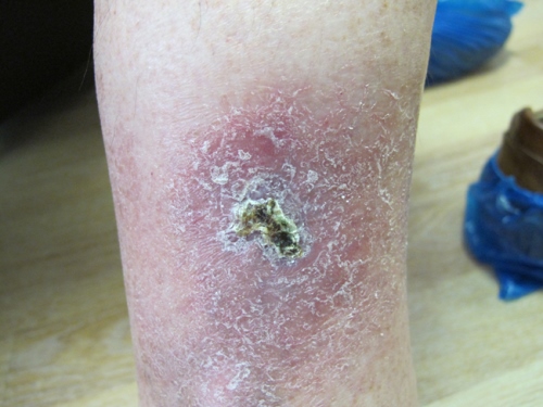 ??????????????????????????????? ???????????????????????????????