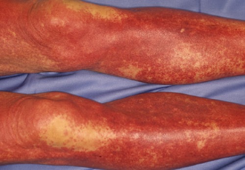 Dermatology Image by Yasusi Suzumura Dermatology Image by Yasusi Suzumura