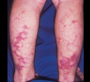 uzelk-per2 uzelk-per2