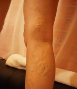 varik-ber3 varik-ber3